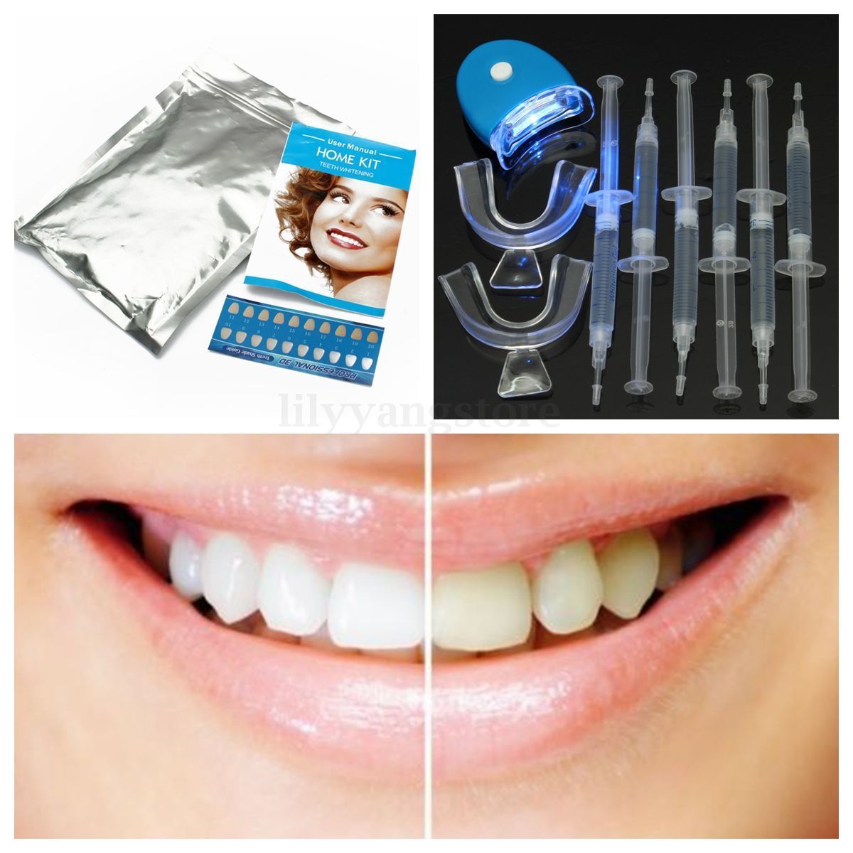Teeth Whitening 44 Peroxide Dental Bleaching System Oral Gel Tooth Whitener Kit
